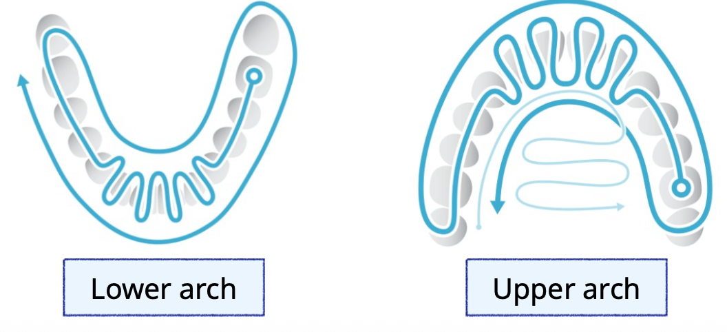 <p>To start with the molar occlusal surface</p>