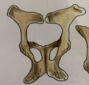 <p>wing of ilium has gluteal line </p>