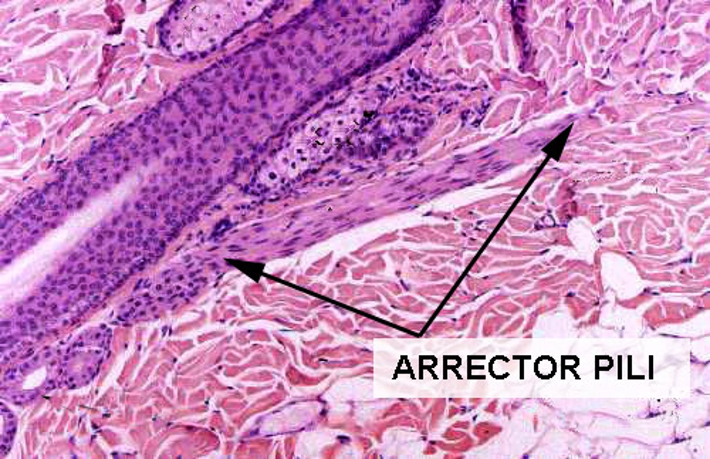 <p>tiny muscle fibers attached to the hair follicles that cause the hair to stand erect</p>