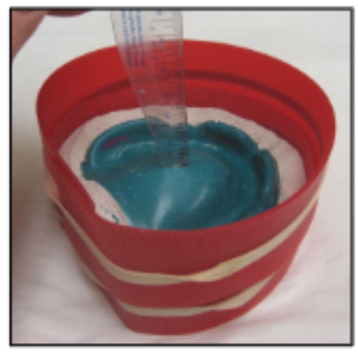 <p>15 mm (usually the depth of the palatal vault on the maxillary cast and the depth of the lingual peripheral roll on the mandibular cast)</p>