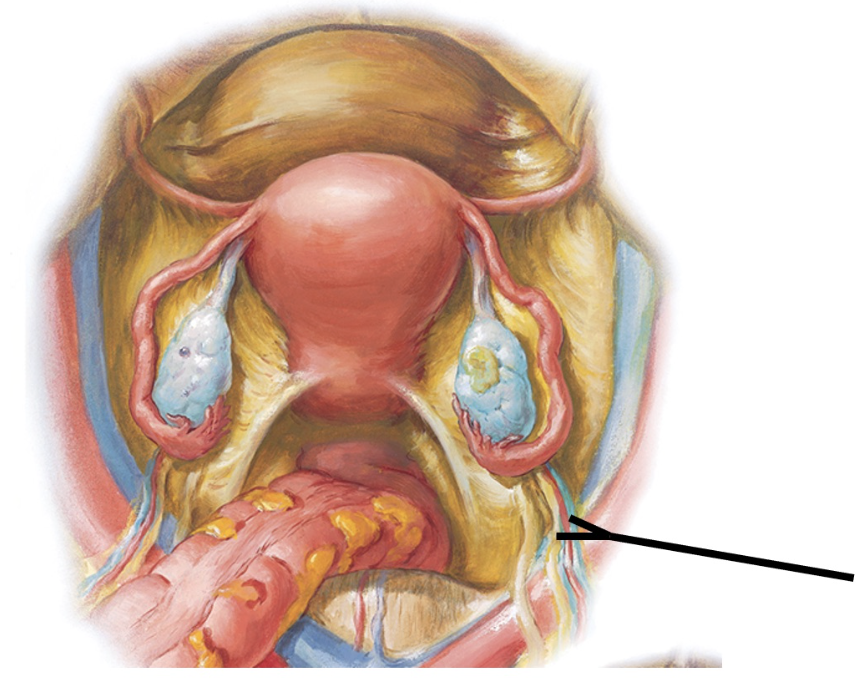 <p><span>Mistakenly severing this structure during surgery would result in damage to which of the following structures contained within it?&nbsp;</span></p>