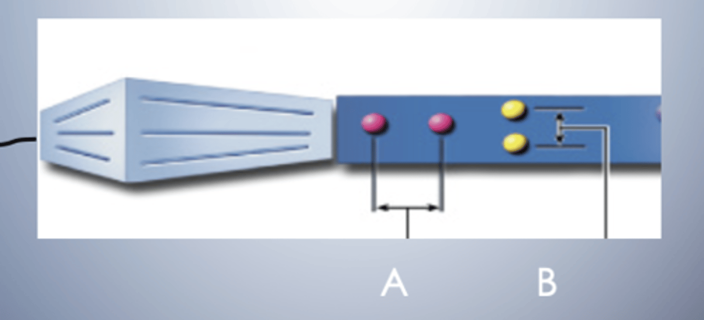 <p>axial resolution is represented by dots A or B?</p>