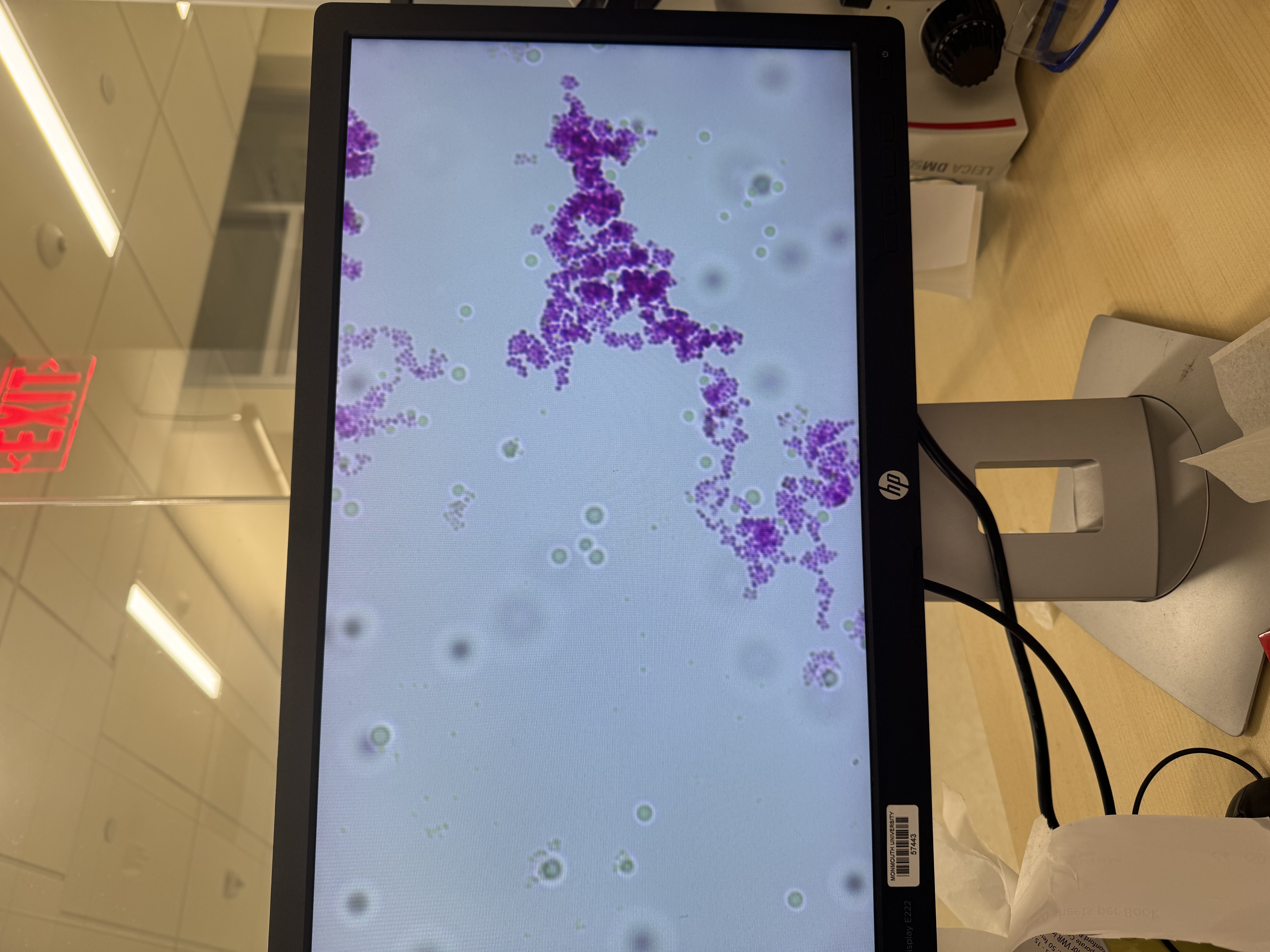 <p>Micrococcus luteus</p>