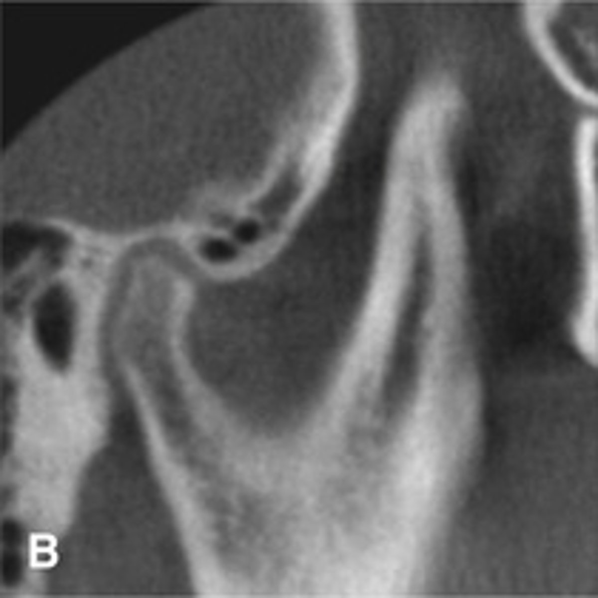 <p>What is this developmental abnormality?</p>