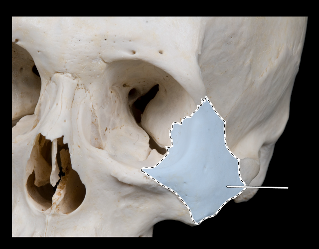 <p>Name this bone.</p><p>(Bones that form the orbit).</p>
