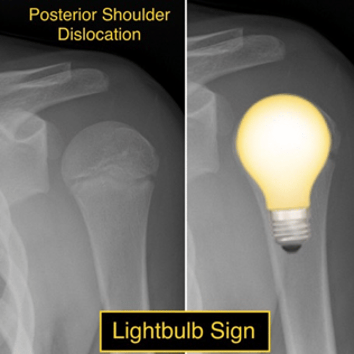 <p>"Light bulb" sign</p>