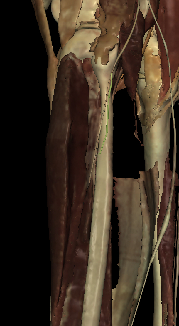 <p>Identify the Structure</p>