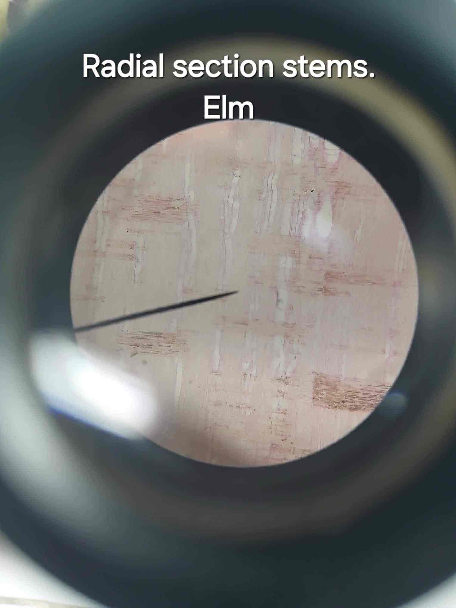 <p>Pits found in the radial section of stems (e.g., Elm) that allow communication between plant cells.</p>