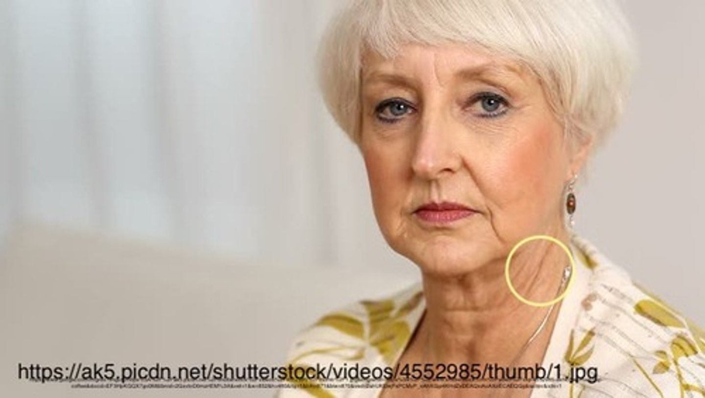 <p>transverse furrow of the neck; acquired</p>