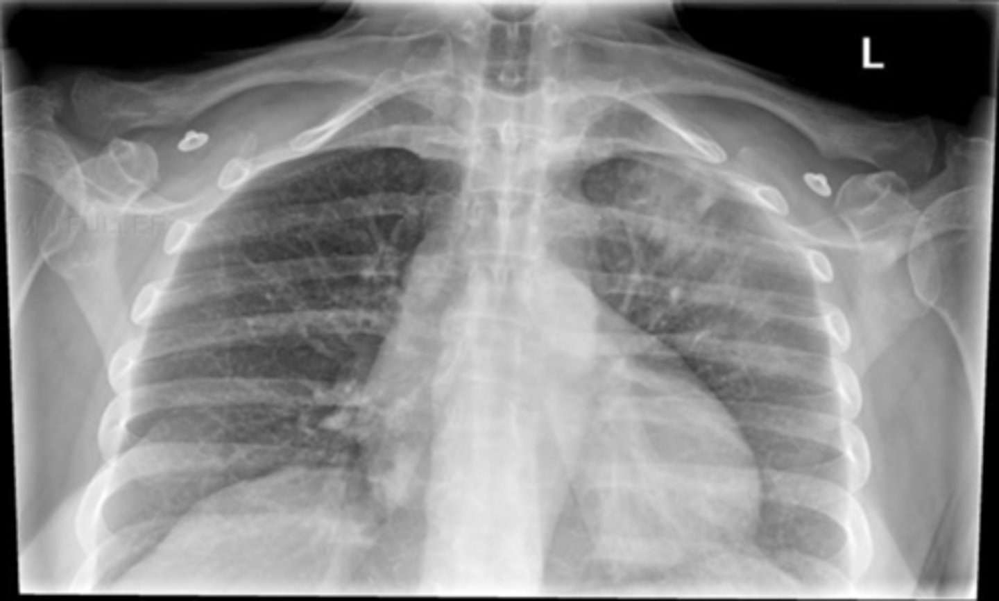 <p>What position is this XRAY in and why?</p>