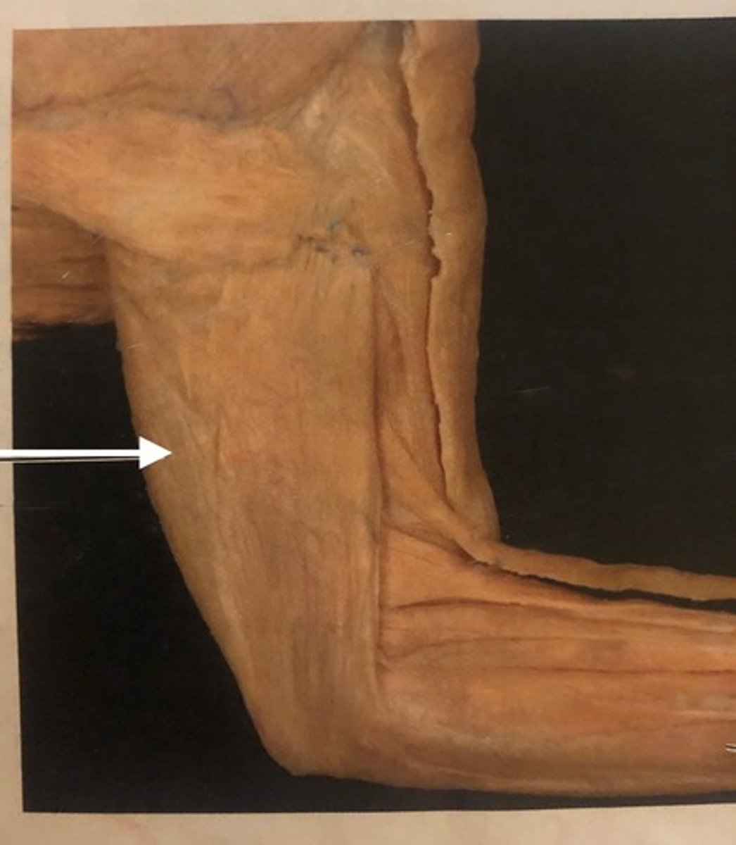 <p>infraglenoid tubercle of scapula</p>