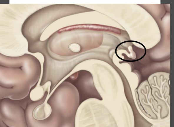 <p>Diencephalon – Epithalamus</p>