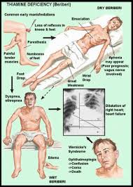<p><strong>Which of the following is the most likely course of Wernicke syndrome?</strong></p><p>A) If the symptoms are correctly diagnosed, most of the effects of the disease can be reversed through better nutrition and supplemental thiamine.</p><p>B) Wernicke syndrome is uniformly fatal, with death most often occurring within a few months of onset.</p><p>C) Wernicke syndrome has no treatment, but drugs may be used to treat its associated dyskinesias and behavioral disturbances.</p><p>D) The course of the disease is relentless, and most affected persons will die of infection within 2 to 10 years.</p>