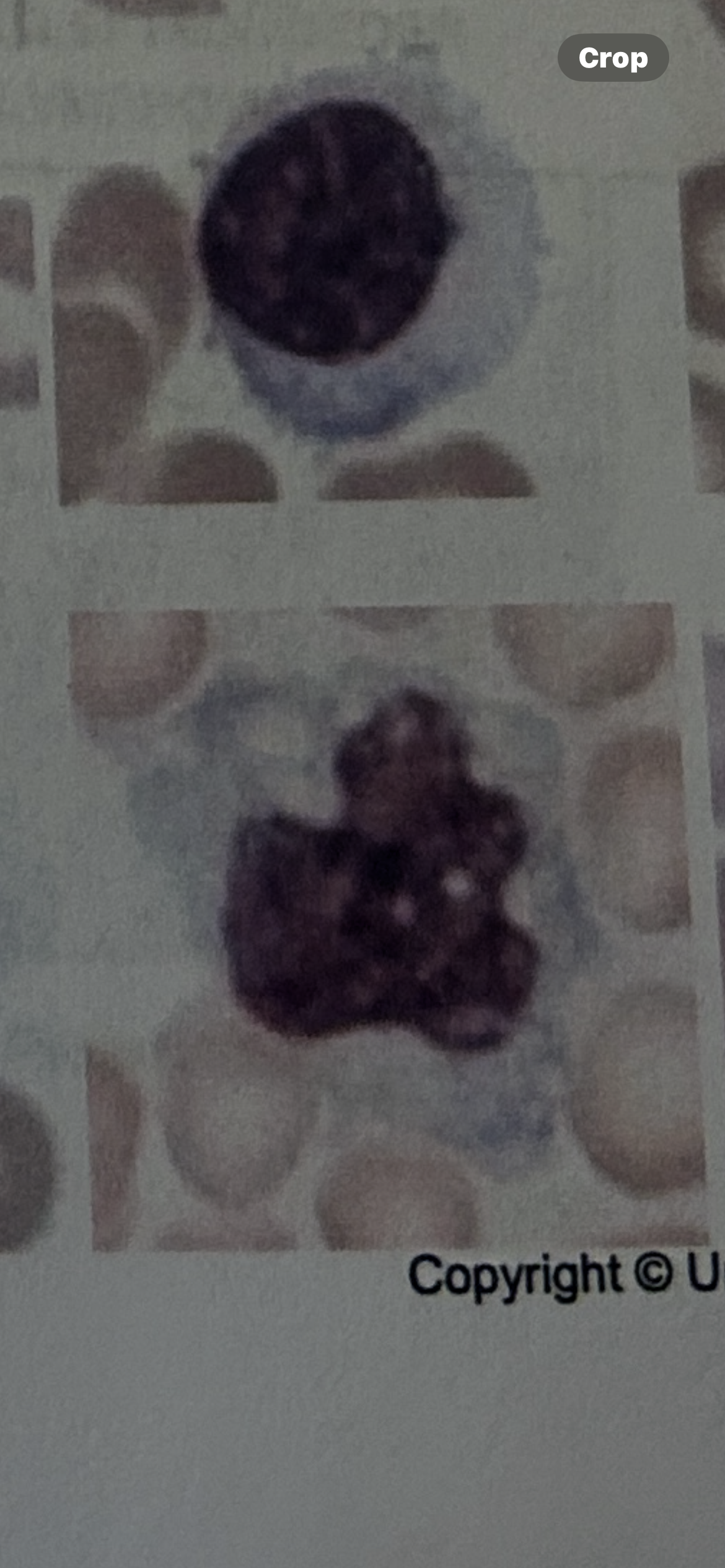 <p>WBC</p>