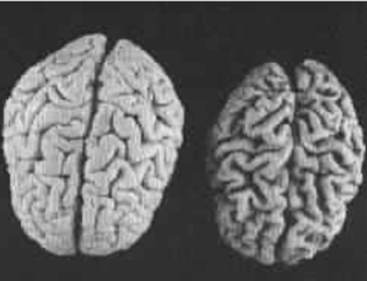 <p>- Peripheral field (e.g. edges of vision)</p><p>- Depth perception</p><p>- Object recognition linked to purpose (e.g. pen, fork)</p><p>- Ability to process, scan, and shift focus</p>