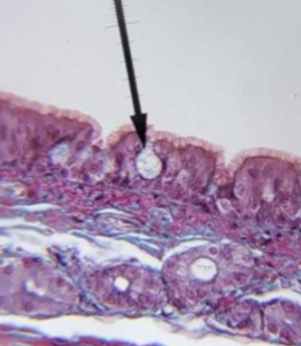 <p>what tyoe of tissue is this and what is the arrow pounting at</p>