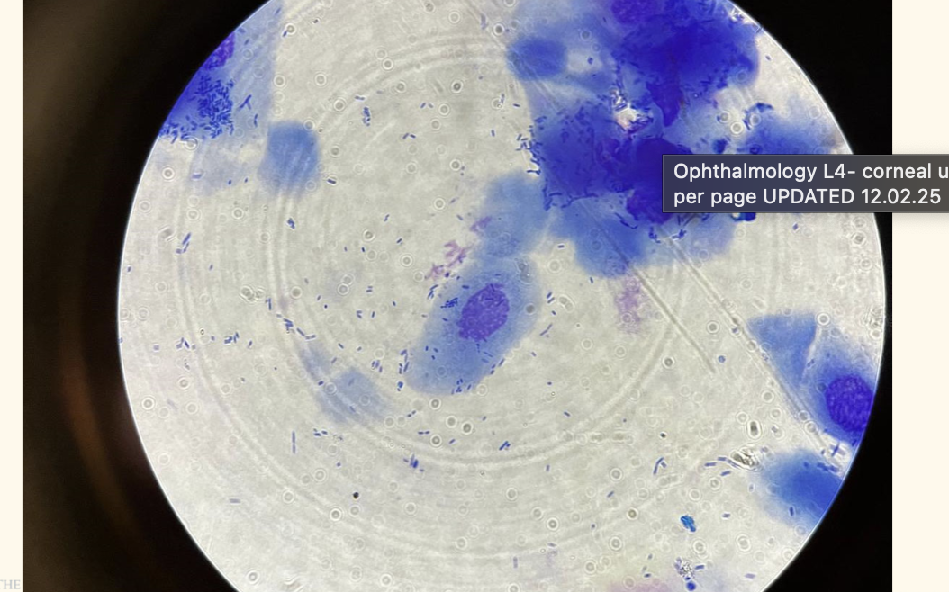 <p><span style="font-size: calc(var(--scale-factor)*17.52px)"><strong>Corneal cytology</strong></span></p><ul><li><p>topical analgesia</p></li><li><p><span style="font-size: calc(var(--scale-factor)*17.52px)">roll ‘Cytobrush’ or bacteriology swab along ulcer</span></p></li></ul><ul><li><p><span style="font-size: calc(var(--scale-factor)*17.52px)">along the edge, avoiding the deeper centre;</span></p><ul><li><p><span style="font-size: calc(var(--scale-factor)*17.52px)">care in very deep ulcers/ Descemetocoeles</span></p></li></ul></li><li><p><span style="font-size: calc(var(--scale-factor)*17.52px)">Roll swab onto a glass slide and ‘Diff Quick’</span></p></li></ul><p></p>