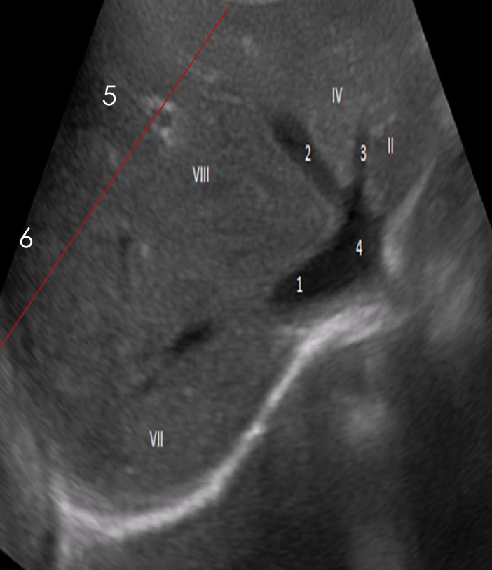 <p>is this an inferior or superior image?</p>