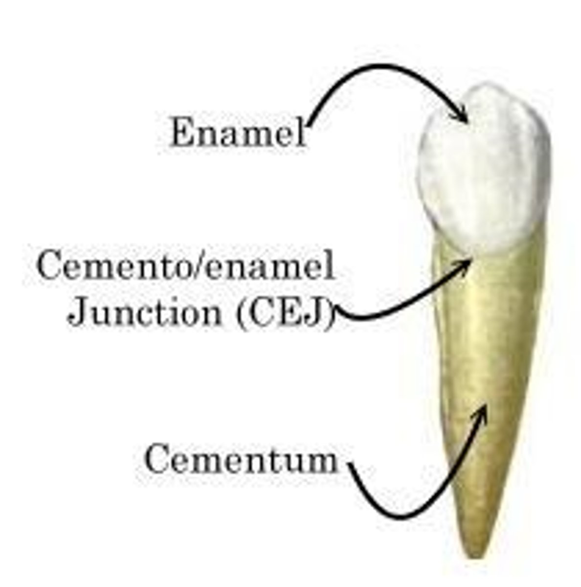 <p>Cementoenamel junction (CEJ)</p>