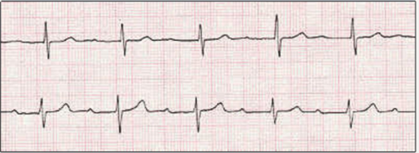 <p>Rhythm?</p><p>Management?</p>