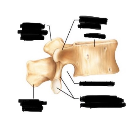 <p>inferior articular process</p>