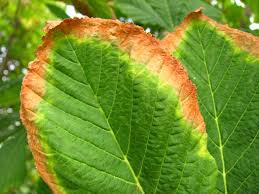 <p>What disease is this?</p>