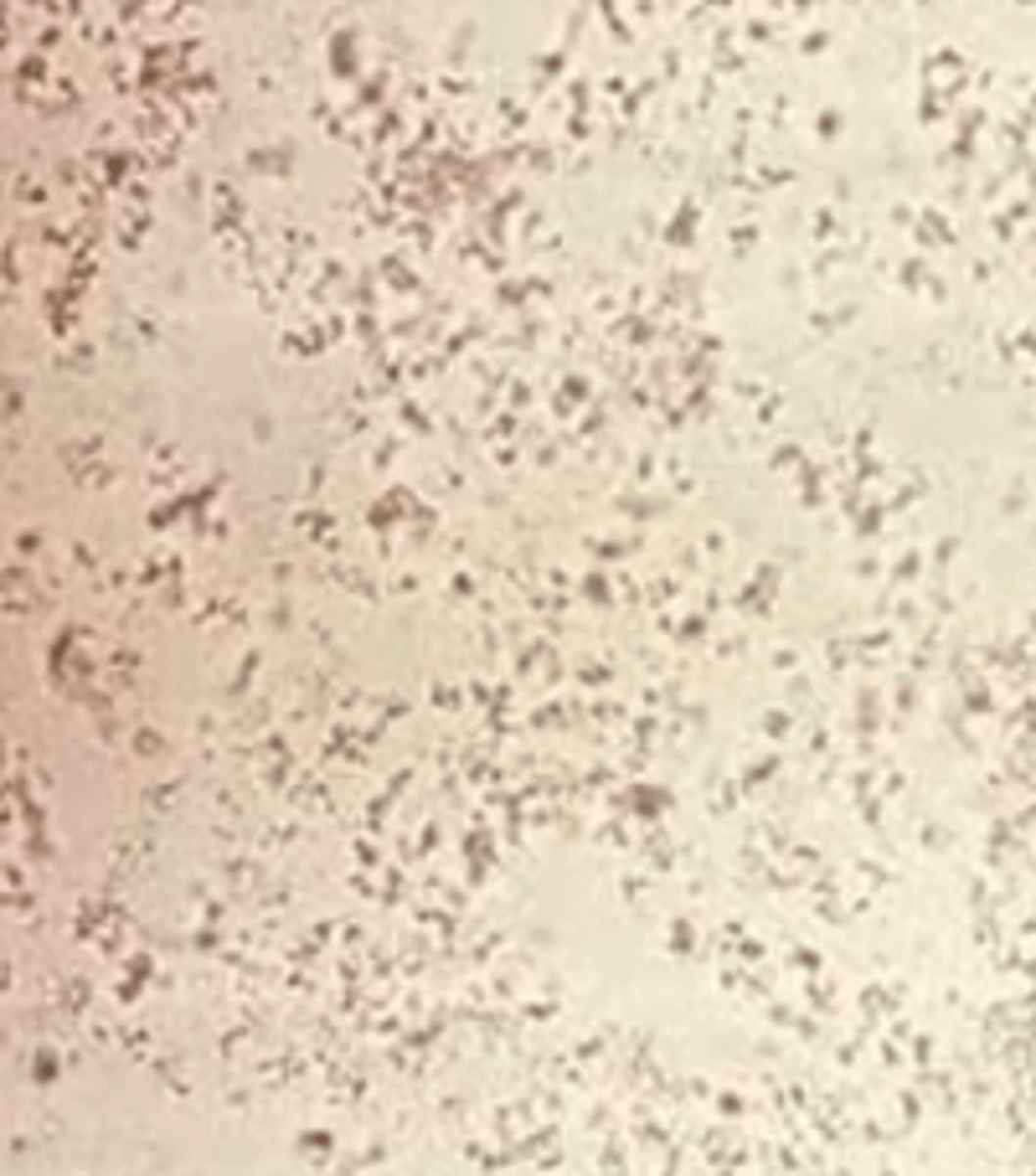 <p>NORMAL</p><p>- acidic</p><p>- formed from salts after refrigeration</p><p>- acidic or neutral urine</p><p>- yellowy, brown, pink</p><p>- can change to uric acid crystals in the presence of HCL</p><p>- re-dissolves when heated to 60 degrees</p>