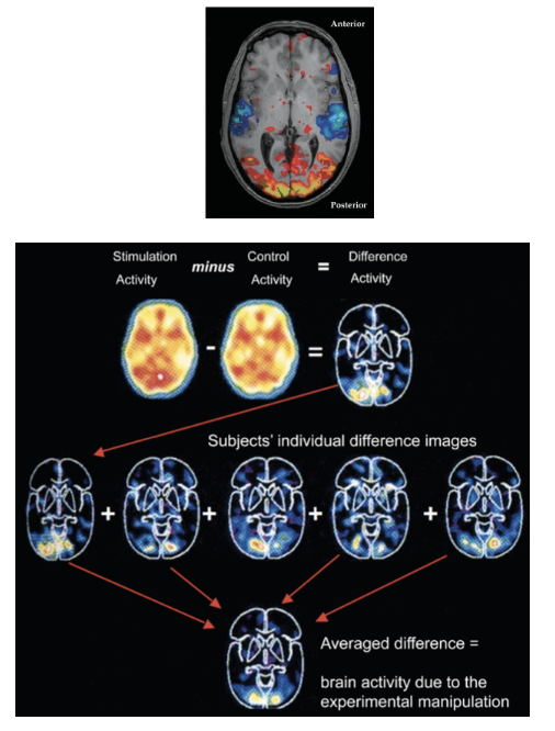 <p>Two Images are Taken:</p><p>• One image is baseline brain activity (e.g., at rest)</p><p>• Another captures activity during a task or stimulus</p><p>• Subtraction Method:</p><p> - Images are subtracted to highlight differences in activity.</p><p> - Areas with increased or decreased BOLD signal show neural activity changes.</p><p>• What It Means:</p><p>- fMRI is correlational, showing patterns of blood flow linked to activity.</p><p>- Is an average across multiple individuals.</p>