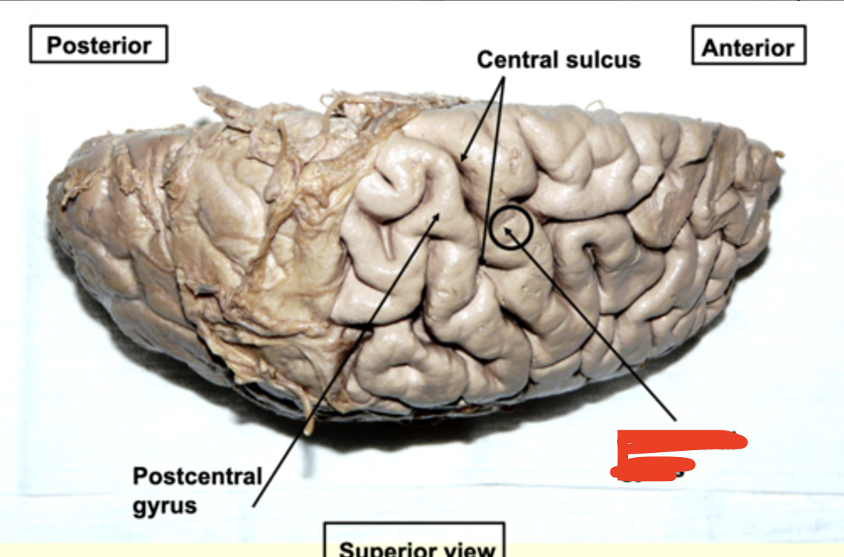 <p>in front of the central sulcus (more anterior)</p>