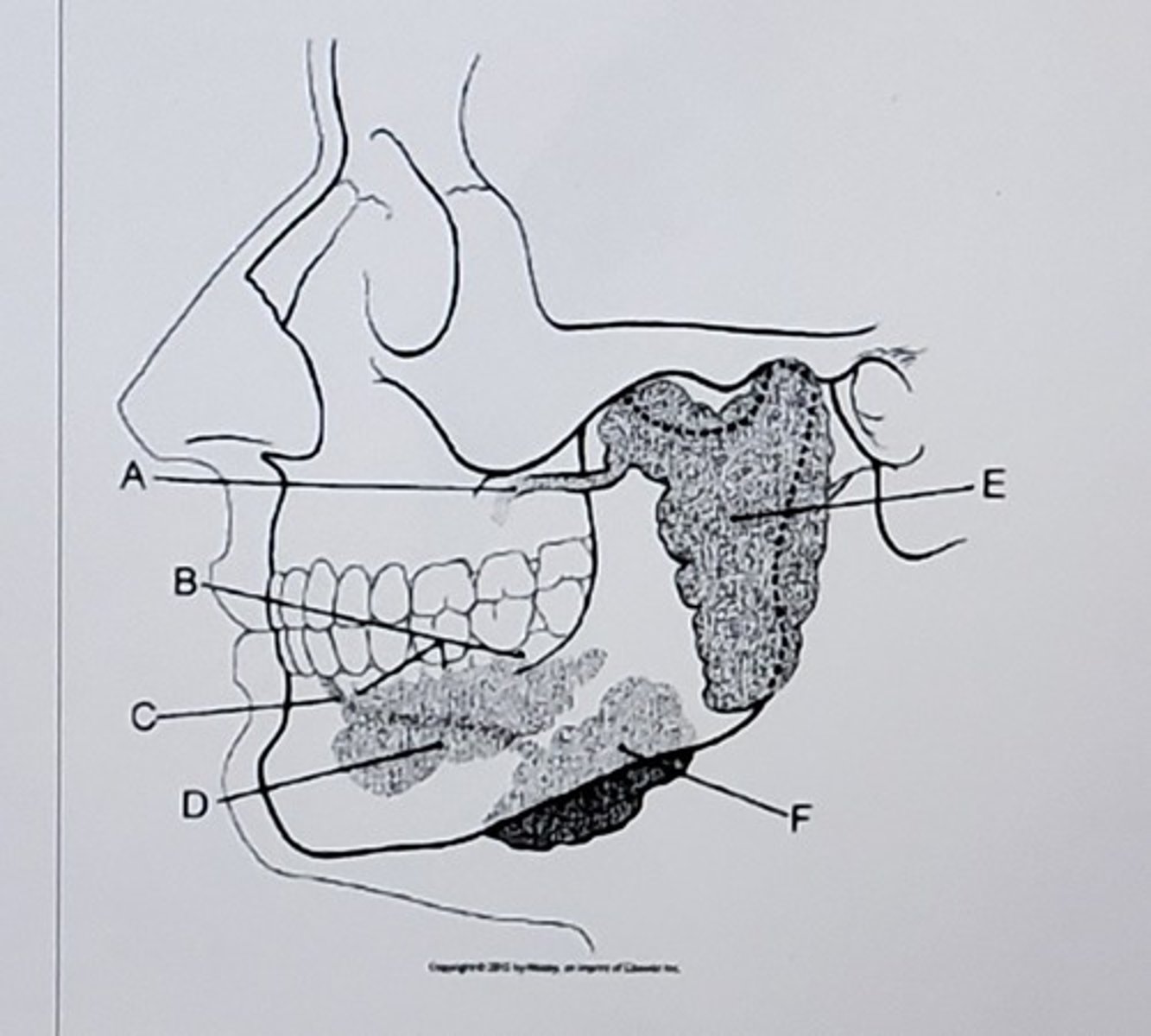 <p>Label the picture:</p>
