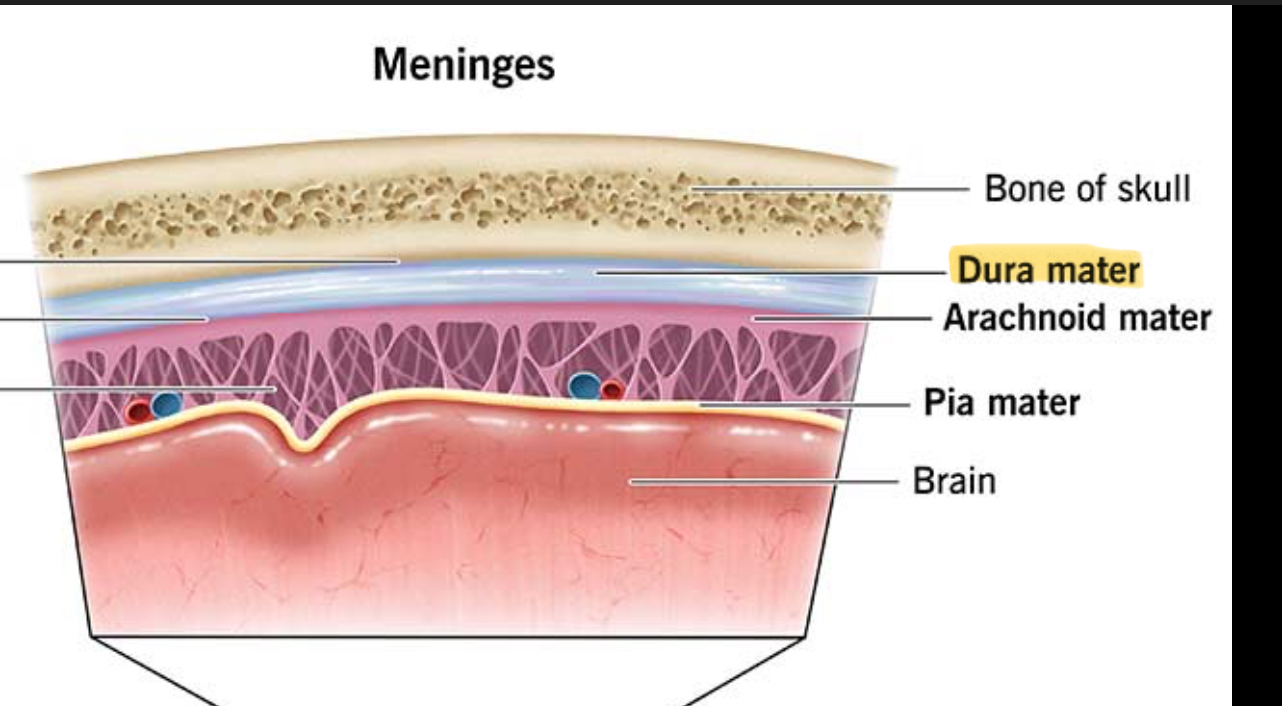 <p>Tough, white dense CT </p>