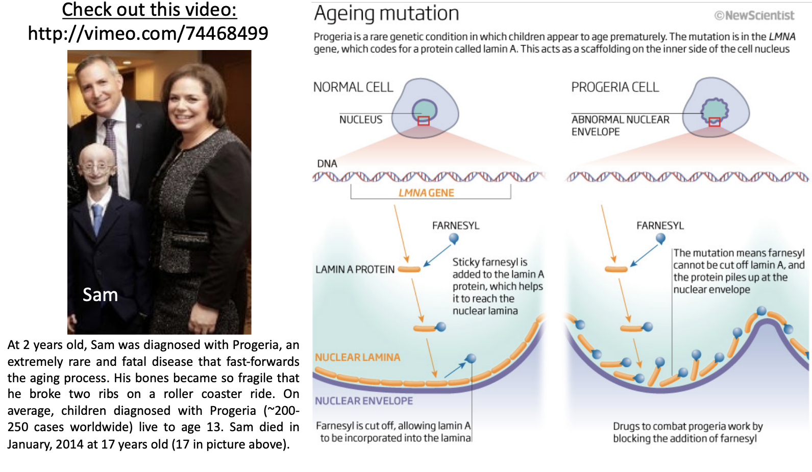 \
* results from mutations in the lamin A gene
  * Premature aging
  * Mutations in lamin A lead to this
  * In normal cells, lamins are farnesylated to get incorporated into lamina and unfarnesylated
  * In progeria cells, lamins are farnesylated but can’t incorporate properly into lamina because can’t unfarnesylated
  * Nuclear envelope is disfigured
  * Telomere biology can’t happen causing again