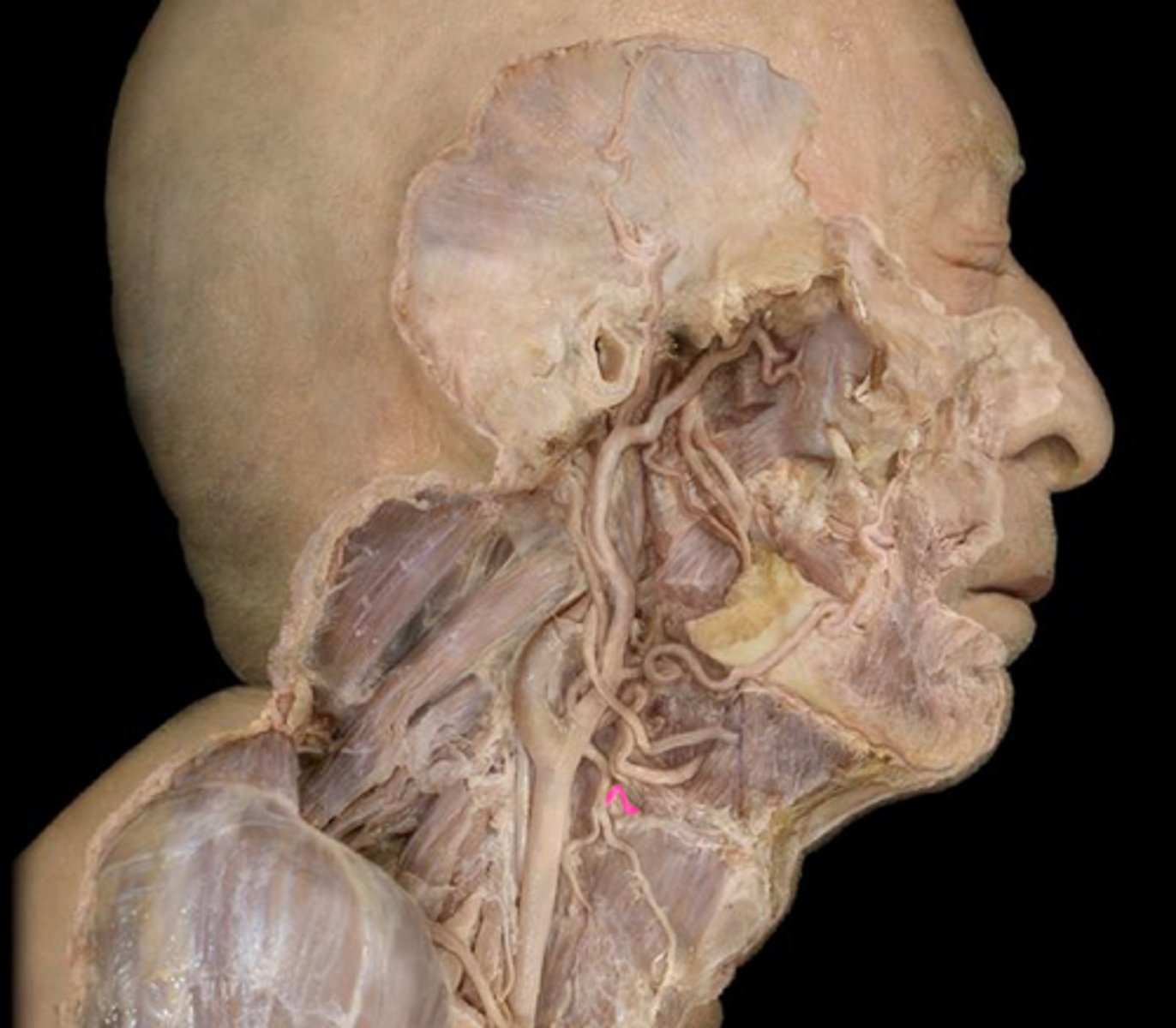 <p>Travels with internal laryngeal nerve through the thyrohyoid membrane</p>