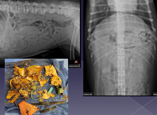 <p><span>Gastric Foreign Body</span></p>