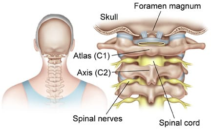<p>Cervical region The atlas (c1): holds up head </p>