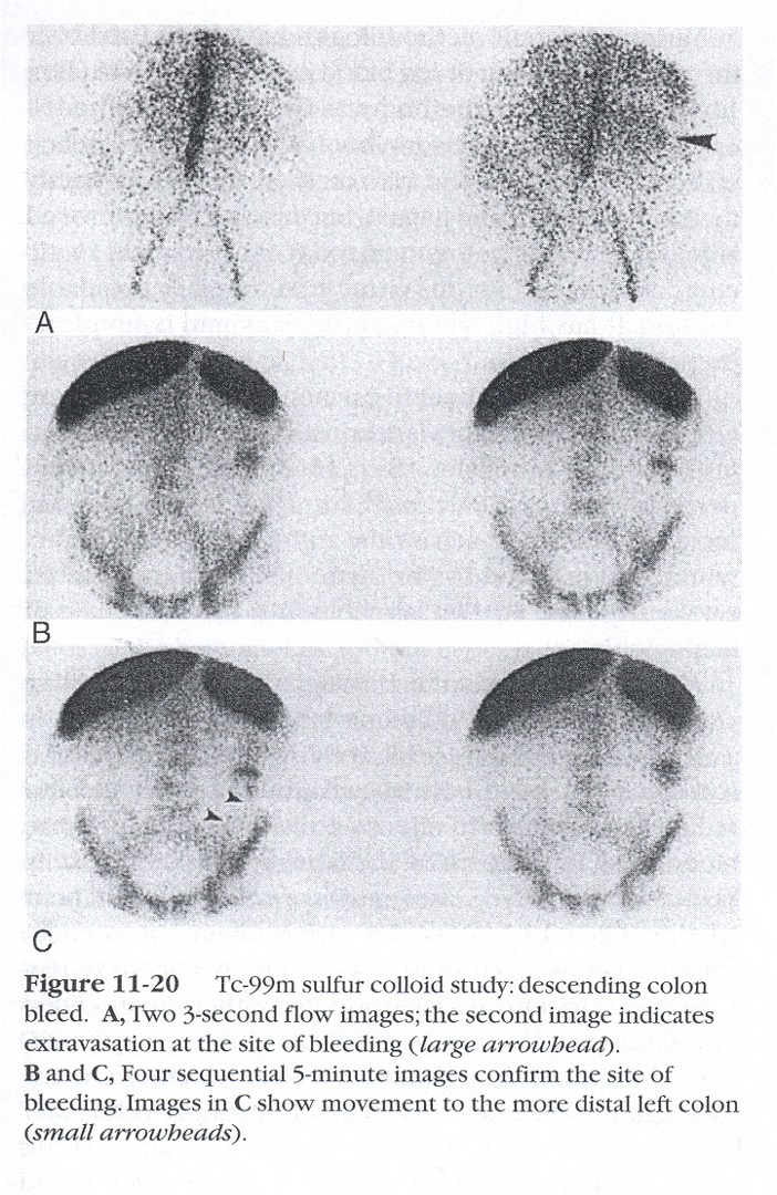 <p>is this using Tc-RBC’s or Tc-SC?</p>