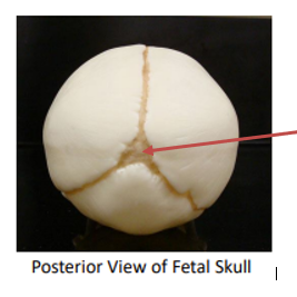 <p><span>Name the structure indicated by the red arrow. Posterior view of fetal skull.</span></p>