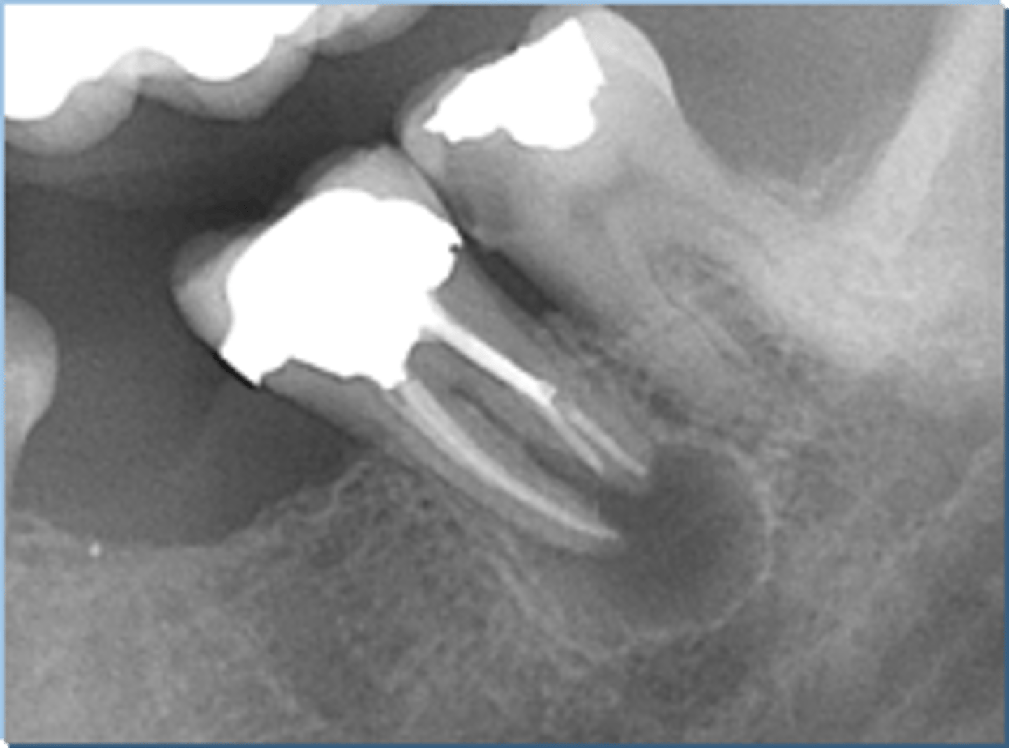 <p>ID the cyst:</p>