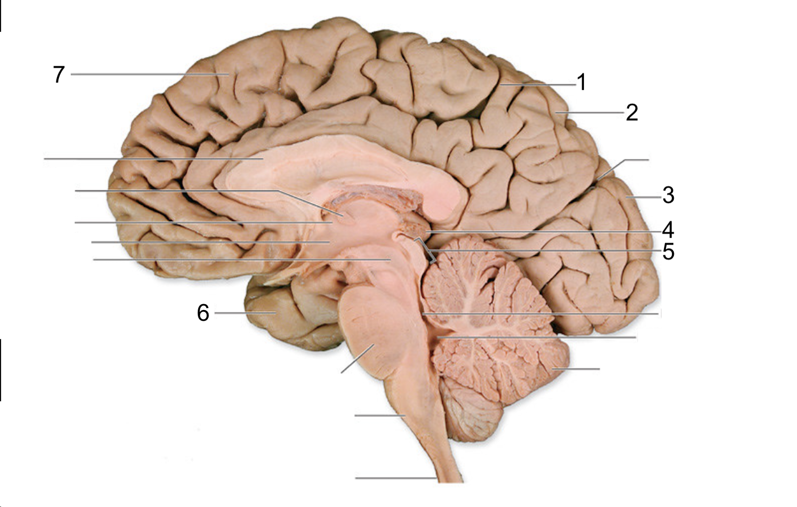 <p>What structure of the brain is this? #7</p>