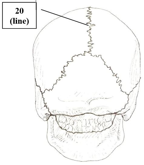 <p>Skull (Posterior view)</p>
