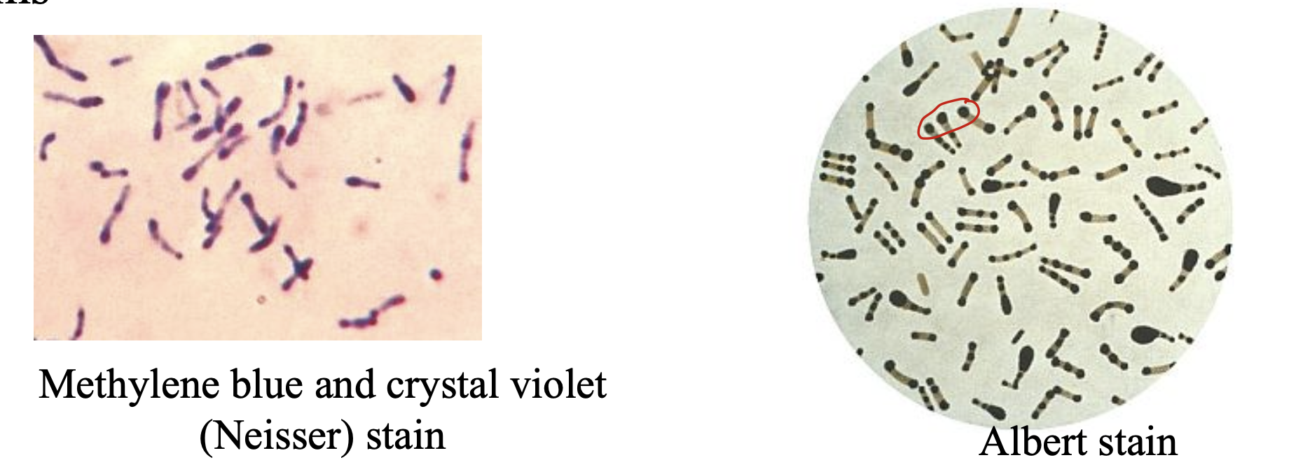 <ul><li><p>Volutin (metachromatic) dark purple granules composed of inorganic polyphosphates (volutin) giving the rods a beaded appearance when stained with Neisser or Albert stains</p></li></ul><p></p>