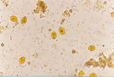 <p><span>This was found on a zinc sulfate fecal flotation (iodine added)&nbsp;of a puppy with diarrhea. What is it most likely to be?</span></p>