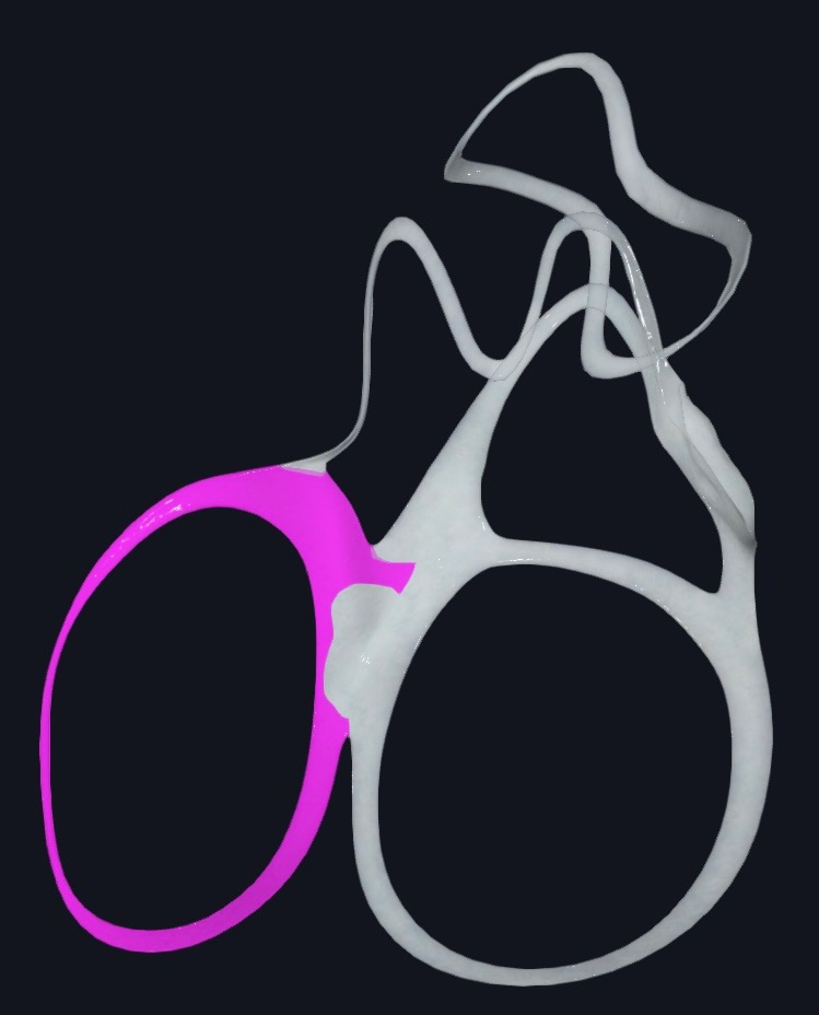 <p>Right fibrous trigone<br />
Left fibrous trigone</p>