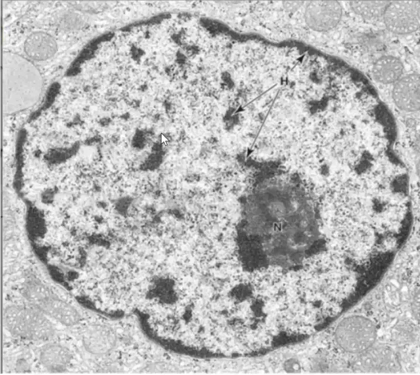 <p>Identify the following structures in electron micrograph (the whole structure)</p>