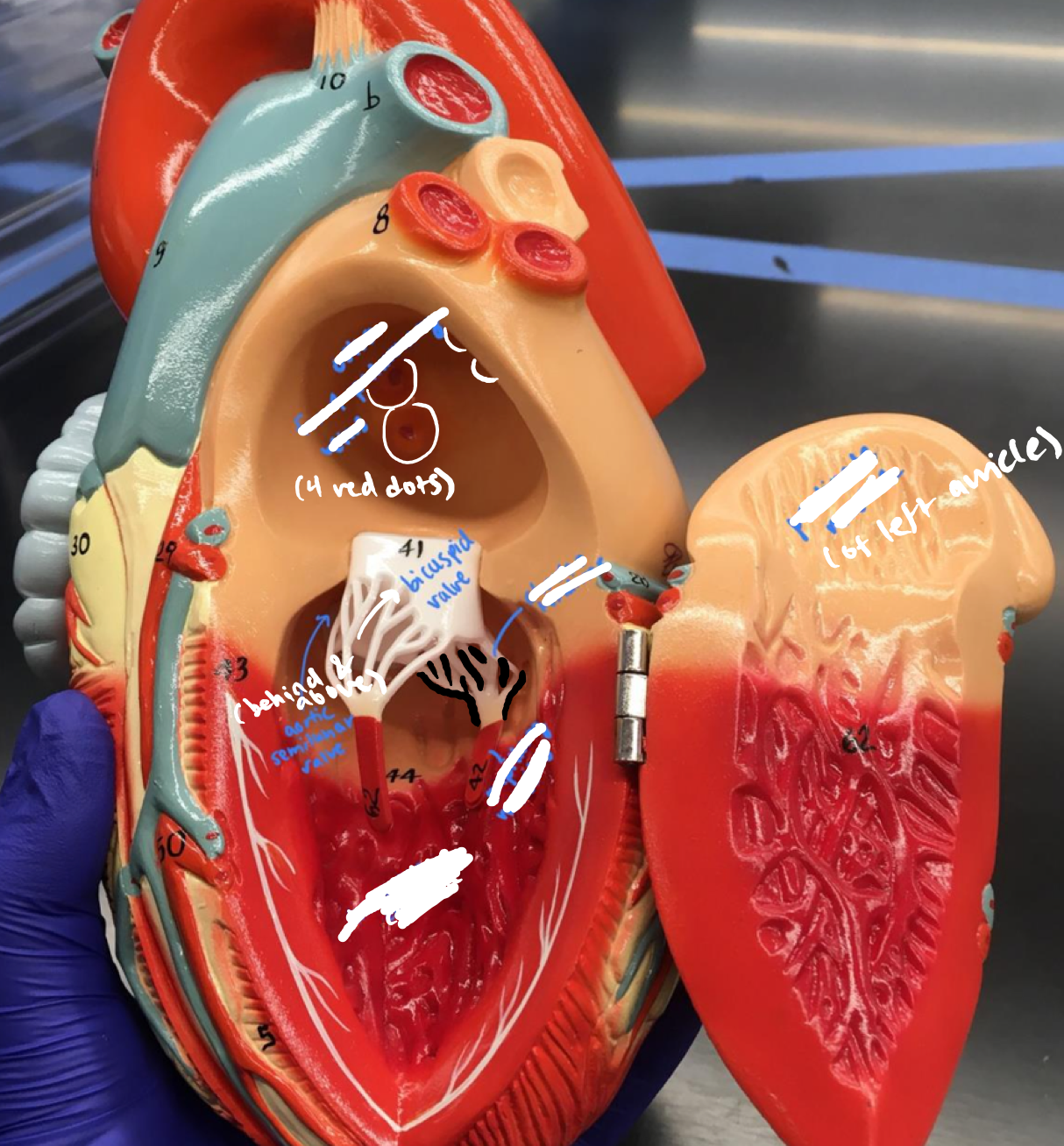 <p>The white connections from the papillary muscles to the valve under the bicuspid valve</p>