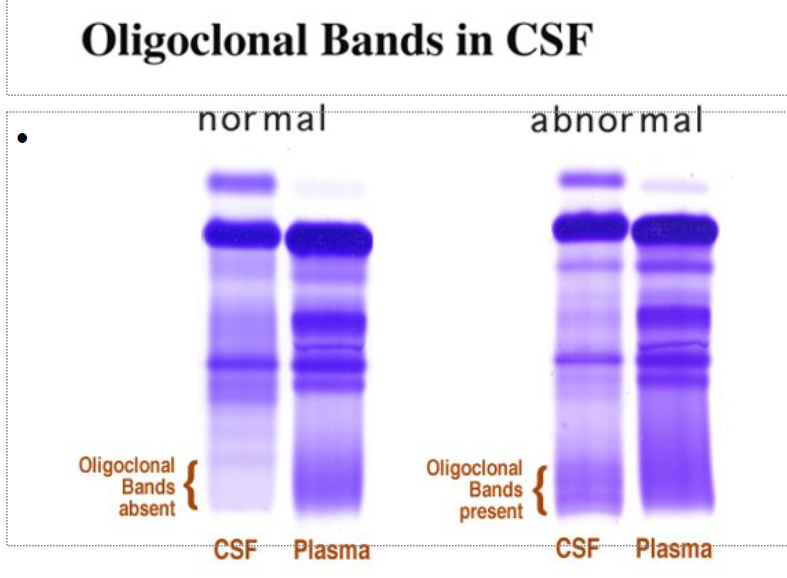 <p>CSF contains all proteins present in serum smaller quantities</p>
