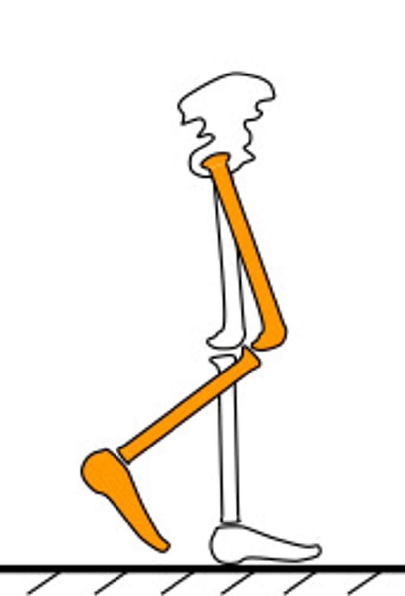 <p>60-75%</p><p>When the foot first leaves the ground the knee and hip move into greater flexion.</p><p>Initial swing continues until the foot is next to the opposite leg.</p><p>At this point, the knee begins to straighten.</p><p>Important for clearance of the foot through swing limb advancement.</p>