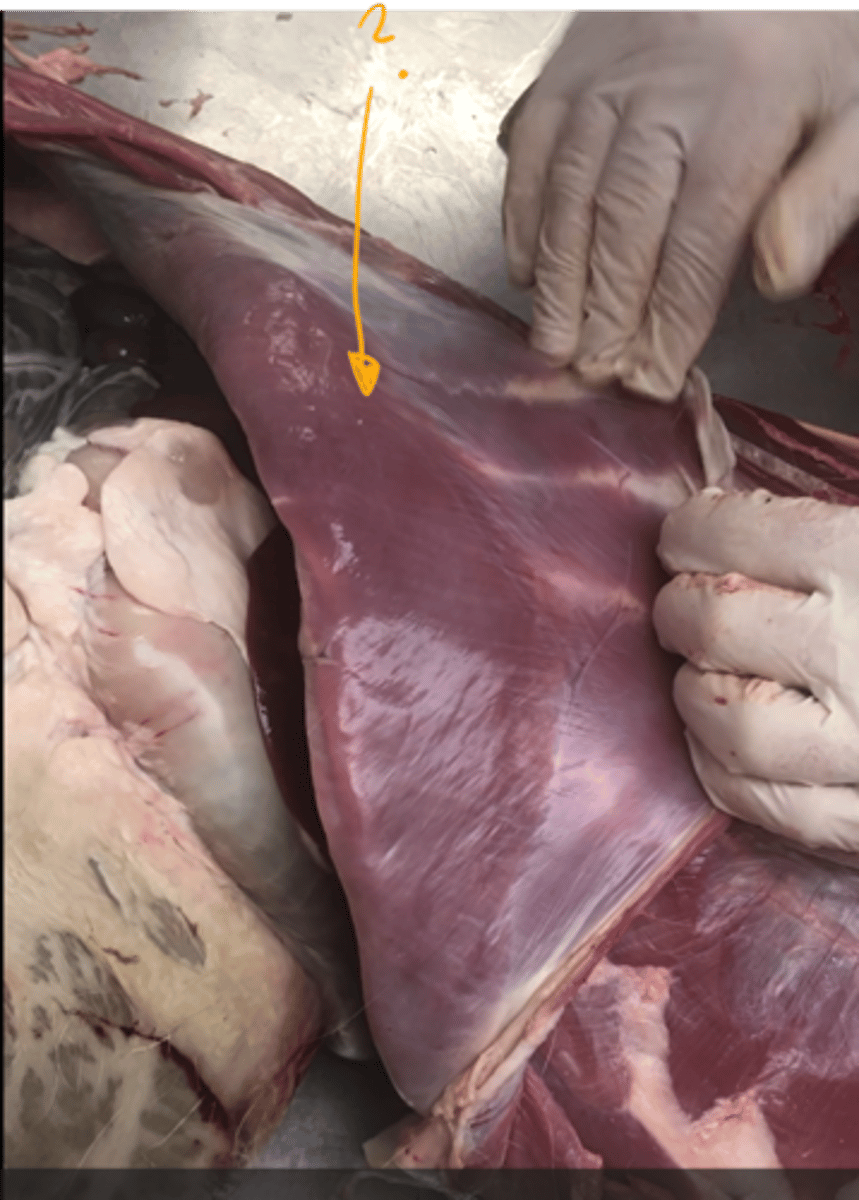 <p>which muscle is this?</p><p><em>- underneath the m. rectus abdominis.</em> </p>