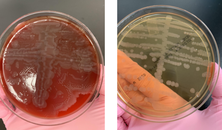 <p>lets say the oxidase was (-), what next steps would you take</p>