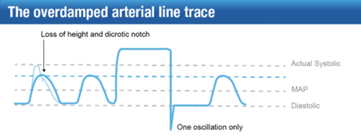 <p>one oscillation only</p>